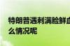 特朗普遇刺满脸鲜血一个不祥的信号 到底什么情况呢